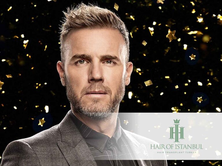 gary-barlow-41.jpeg