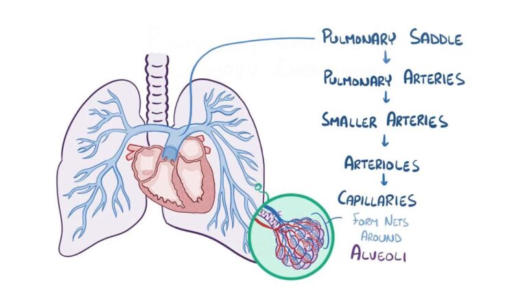 pulmonary-embolism-114.jpeg
