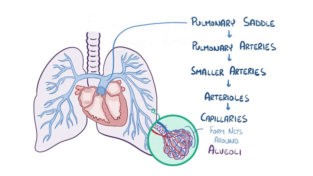 pulmonary-embolism-114.jpeg
